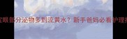 宝宝眼部分泌物多到流黄水新手爸妈必看护理指南