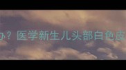 婴儿头上长白色脓包怎么办医学新生儿头部白色皮疹的成因与家庭护理指南