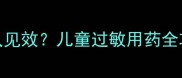 宝宝服用开瑞坦多久见效儿童过敏用药全攻略及家长必知事项