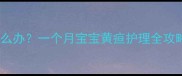 新生儿黄疸眼白发黄怎么办一个月宝宝黄疸护理全攻略附家庭处理指南