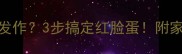 婴幼儿湿疹反复发作3步搞定红脸蛋附家庭护理全攻略