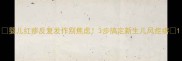 婴儿红疹反复发作别焦虑3步搞定新生儿风疙瘩