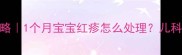 新生儿下巴痘痘全攻略1个月宝宝红疹怎么处理儿科医生亲授家庭护理法