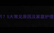 宝宝皮肤突然发红一片5大常见原因及家庭护理指南附医生建议