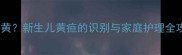 两个月宝宝脸黄手不黄新生儿黄疸的识别与家庭护理全攻略附就医指南