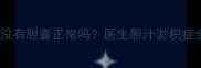 新生儿没有胆囊正常吗医生胆汁淤积症全攻略