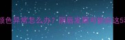 新生儿外阴颜色异常怎么办阴唇发黑可能由这5种原因导致