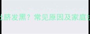 3个月宝宝肚脐发黑常见原因及家庭护理全攻略