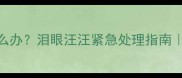 新生儿眼部分泌物多怎么办泪眼汪汪紧急处理指南眼科医生教你3步解决