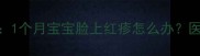 新生儿湿疹护理全攻略1个月宝宝脸上红疹怎么办医生建议的5个实用方法