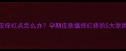 怀孕5个月肚皮痒红点怎么办孕期皮肤瘙痒红疹的5大原因及应对措施