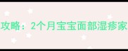 新生儿湿疹护理全攻略2个月宝宝面部湿疹家庭处理与预防指南