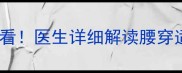 婴儿做腰穿检查家长必看医生详细解读腰穿适应症风险及注意事项