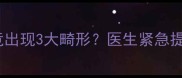 孕期误服禁药后胎儿竟出现3大畸形医生紧急提醒附孕期禁药红黑榜