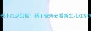 婴儿身上出现小红点别慌新手爸妈必看新生儿红疹护理全攻略
