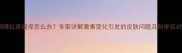 孕期脚踝红疹瘙痒怎么办专家详解激素变化引发的皮肤问题及科学应对方案