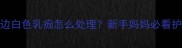 婴儿嘴边白色乳痂怎么处理新手妈妈必看护理指南