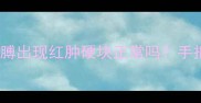 宝宝接种疫苗后胳膊出现红肿硬块正常吗手把手教你处理方法