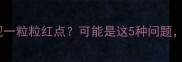宝宝舌头出现一粒粒红点可能是这5种问题家长必看