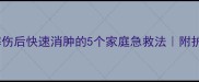 宝宝嘴唇摔伤后快速消肿的5个家庭急救法附护理全攻略