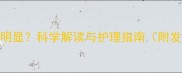 婴儿头盖骨骨缝明显科学解读与护理指南附发育指标对照表