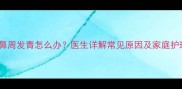 新生儿鼻周发青怎么办医生详解常见原因及家庭护理指南